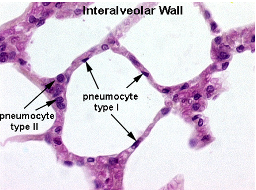 <p>Alveoli</p>