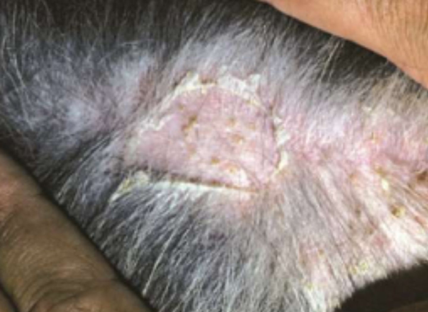 <p>¿lesión?</p><p>¿primaria o secundaria?</p>