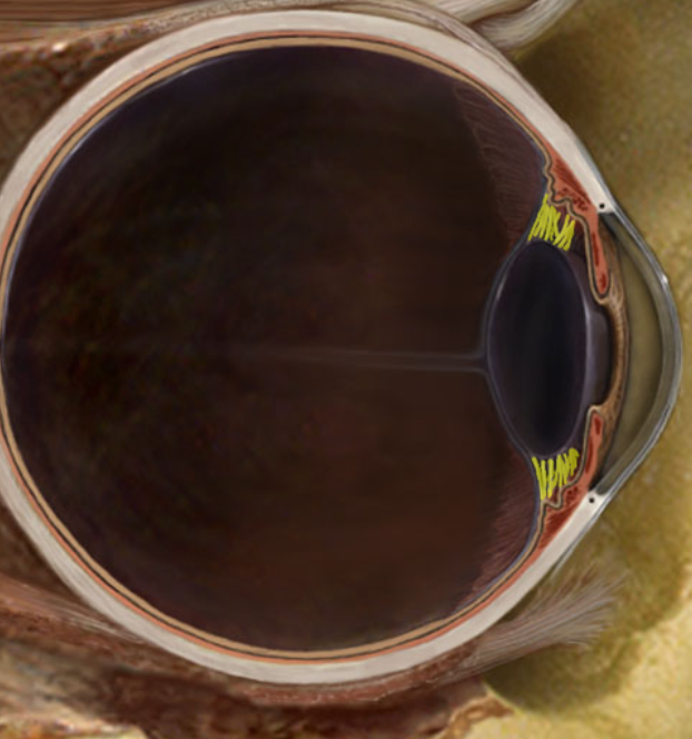 term image