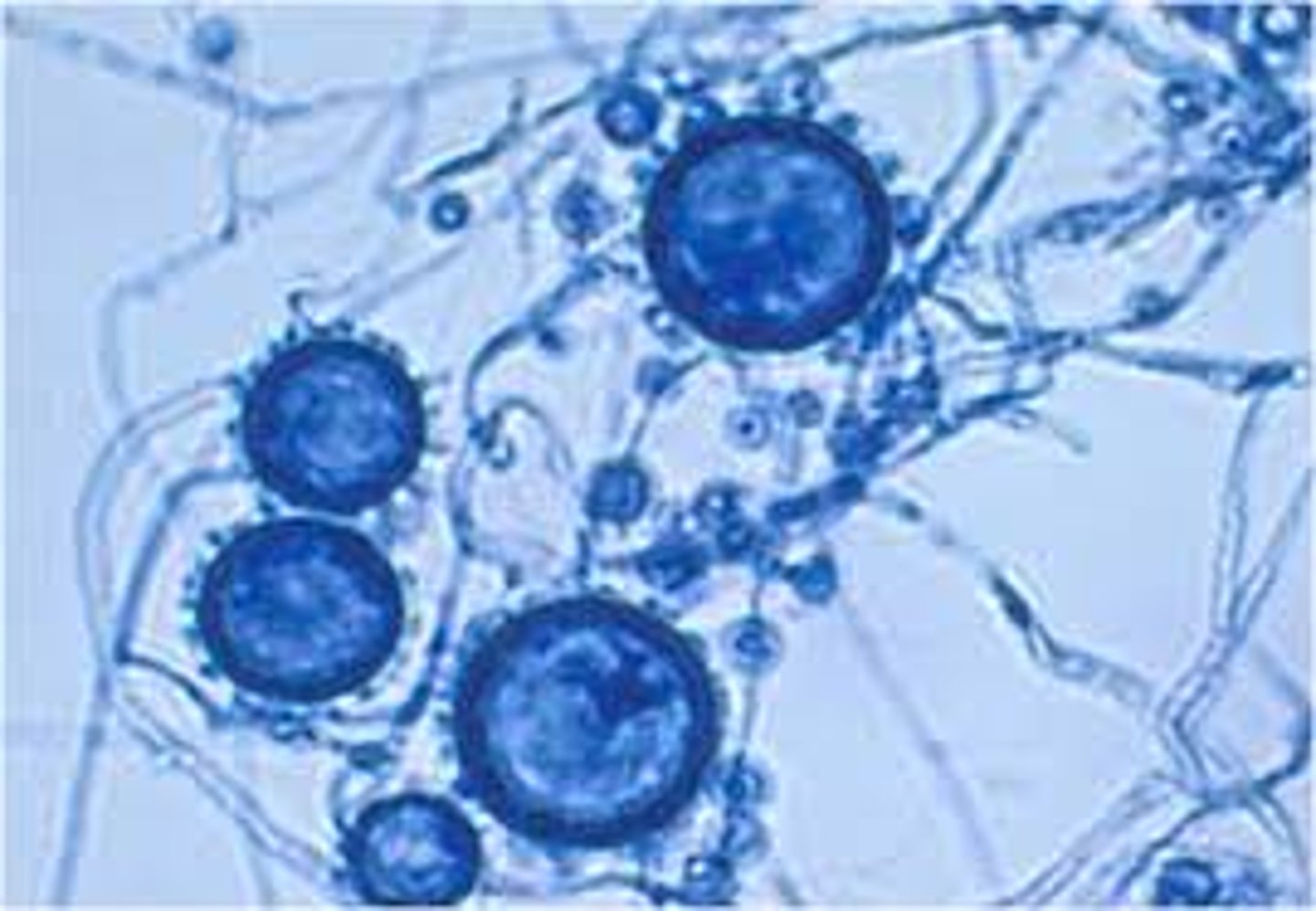 <p>Histoplasmosis</p><p>--inhaled microconidia</p><p>Risk factors: disturbed soil, bird bat dropping exposure, immunocompromised</p><p>Target tissue: pulmonary</p>