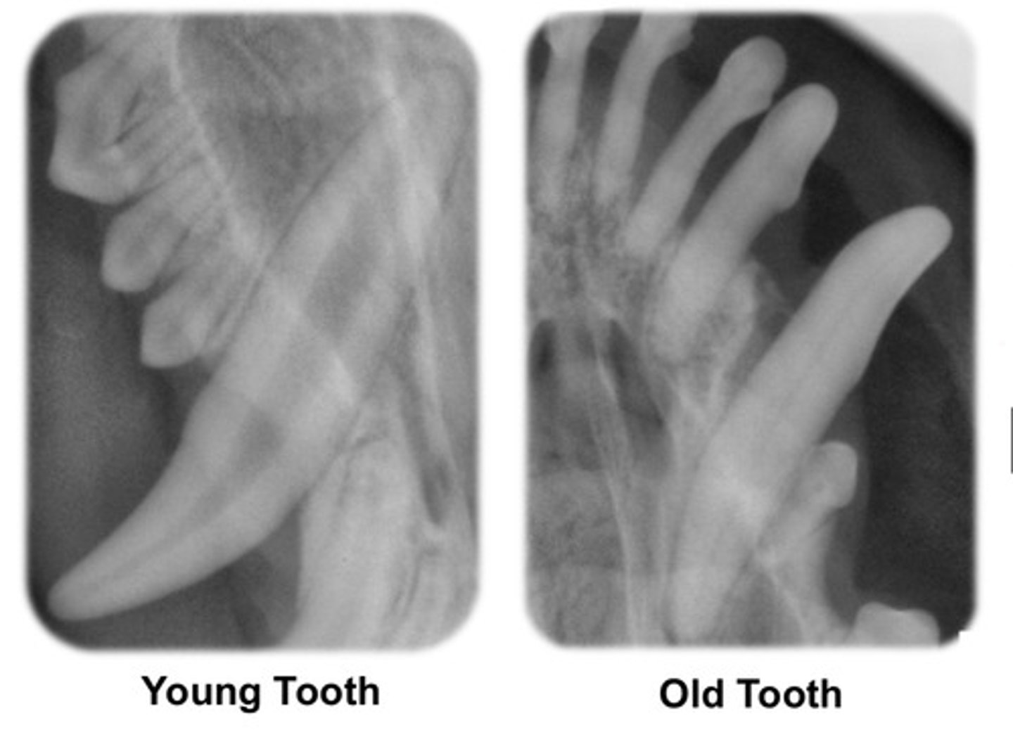 <p>Dentin gets [thicker/thinner] with age.</p>