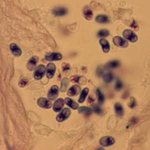 <p>Microsporidia</p><p>1.5 - 2 um</p>