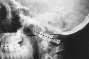<p>Q what is the name of this measurement? and what is the average + range?</p>