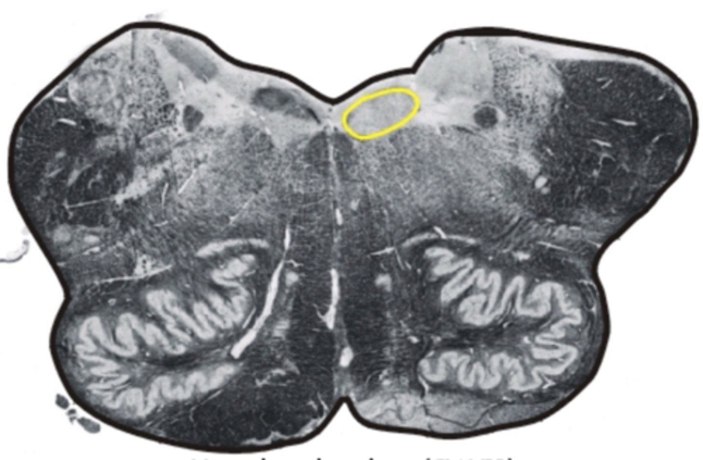 <p>controls movement of tongue and speech</p>