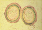 <p>Echinococcus Granulosus </p><p></p><p class="MsoListParagraphCxSpMiddle"><span><span>-</span></span><span style="font-family: "Times New Roman"; line-height: normal; font-size: 7pt;"><span>&nbsp;&nbsp;&nbsp;&nbsp;&nbsp;&nbsp;&nbsp; </span></span>Infection of dog</p><p class="MsoListParagraphCxSpMiddle"><span style="font-family: "Courier New";"><span>o</span></span><span style="font-family: "Times New Roman"; line-height: normal; font-size: 7pt;"><span>&nbsp;&nbsp; </span></span><span style="background-color: yellow;"><span>ingestion of offal (liver/lungs</span></span>) from IH containing fertile cysts</p><p class="MsoListParagraphCxSpMiddle"></p><p class="MsoListParagraphCxSpMiddle"><span style="font-family: "Courier New";"><span>o</span></span><span style="font-family: "Times New Roman"; line-height: normal; font-size: 7pt;"><span>&nbsp;&nbsp; </span></span>sheep, or wildlife most likely – <span style="background-color: yellow;"><span>many mammals are IH, including humans</span></span></p><p class="MsoListParagraphCxSpMiddle"><span><span>-</span></span><span style="font-family: "Times New Roman"; line-height: normal; font-size: 7pt;"><span>&nbsp;&nbsp;&nbsp;&nbsp;&nbsp;&nbsp;&nbsp; </span></span>Control on farm</p><p class="MsoListParagraphCxSpMiddle"><span style="background-color: yellow; font-family: "Courier New";"><span>o</span></span><span style="background-color: yellow; font-family: "Times New Roman"; line-height: normal; font-size: 7pt;"><span>&nbsp;&nbsp; </span></span><span style="background-color: yellow;"><span>Drontal (prazi, febantel, pyrantel)</span></span></p><p class="MsoListParagraphCxSpMiddle"><span style="font-family: "Courier New";"><span>o</span></span><span style="font-family: "Times New Roman"; line-height: normal; font-size: 7pt;"><span>&nbsp;&nbsp; </span></span>Treat dogs 5-6weekly, don’t feed offal (even cooked) or dead carcases</p><p class="MsoListParagraphCxSpMiddle"><span style="font-family: "Courier New";"><span>o</span></span><span style="font-family: "Times New Roman"; line-height: normal; font-size: 7pt;"><span>&nbsp;&nbsp; </span></span>Reduce stray population</p><p class="MsoListParagraphCxSpMiddle"><span style="font-family: "Courier New";"><span>o</span></span><span style="font-family: "Times New Roman"; line-height: normal; font-size: 7pt;"><span>&nbsp;&nbsp; </span></span>Don’t allow dogs into farm/ abattoir</p><p class="MsoListParagraphCxSpMiddle"><span style="font-family: "Courier New";"><span>o</span></span><span style="font-family: "Times New Roman"; line-height: normal; font-size: 7pt;"><span>&nbsp;&nbsp; </span></span>Educate farmer/dog owner</p><p class="MsoListParagraphCxSpMiddle"><span><span>-</span></span><span style="font-family: "Times New Roman"; line-height: normal; font-size: 7pt;"><span>&nbsp;&nbsp;&nbsp;&nbsp;&nbsp;&nbsp;&nbsp; </span></span>Sig for humans</p><p class="MsoListParagraphCxSpMiddle"><span style="font-family: "Courier New";"><span>o</span></span><span style="font-family: "Times New Roman"; line-height: normal; font-size: 7pt;"><span>&nbsp;&nbsp; </span></span>Taenia spp in Aus – no significance&nbsp;</p><p class="MsoListParagraphCxSpMiddle"></p><p class="MsoListParagraphCxSpMiddle"><span style="font-family: "Courier New";"><span>o</span></span><span style="font-family: "Times New Roman"; line-height: normal; font-size: 7pt;"><span>&nbsp;&nbsp; </span></span>Echinococcus – humans IH &amp; DH</p><p class="MsoListParagraphCxSpMiddle"><span style="font-size: 14.08px;"><span>-</span></span><span style="font-size: 7pt;"><span>&nbsp; </span></span>Ingest eggs from infected dogs - Even manipulating coat (eggs adhere)</p><p class="MsoListParagraphCxSpMiddle"><span style="font-size: 14.08px;"><span>-</span></span><span style="font-size: 7pt;"><span>&nbsp; </span></span>Ingest food/water with egg</p><p class="MsoListParagraphCxSpMiddle"><span><span>-</span></span><span style="font-family: "Times New Roman"; line-height: normal; font-size: 7pt;"><span>&nbsp;&nbsp;&nbsp;&nbsp;&nbsp;&nbsp;&nbsp; </span></span><span style="background-color: yellow;"><span>Difference in infection E. granulosus v Taenia spp. for humans</span></span></p><p class="MsoListParagraphCxSpMiddle"><span style="font-family: "Courier New";"><span>o</span></span><span style="font-family: "Times New Roman"; line-height: normal; font-size: 7pt;"><span>&nbsp;&nbsp; </span></span>Eggs of echinococcus <span style="background-color: yellow;"><span>directly infective when shed</span></span> in env for humans</p><p class="MsoListParagraphCxSpMiddle"><span style="font-family: "Courier New";"><span>o</span></span><span style="font-family: "Times New Roman"; line-height: normal; font-size: 7pt;"><span>&nbsp;&nbsp; </span></span><span style="background-color: yellow;"><span>Eggs adhere to fur coat</span></span>, can infect humans from patting</p><p class="MsoListParagraphCxSpLast"><span style="font-family: "Courier New";"><span>o</span></span><span style="font-family: "Times New Roman"; line-height: normal; font-size: 7pt;"><span>&nbsp;&nbsp; </span></span>Vs taenia – takes 2w for eggs to become infective, and by then broken down in env</p>