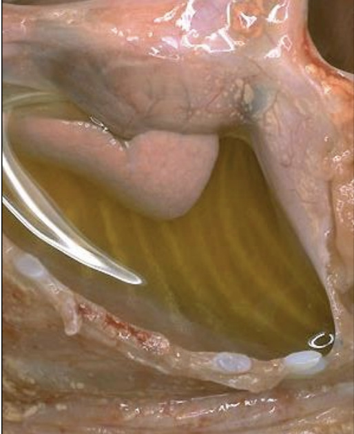 <p>exudate</p>