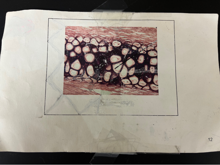 <p>What kind of bone/tissue/cartilage is this?</p>