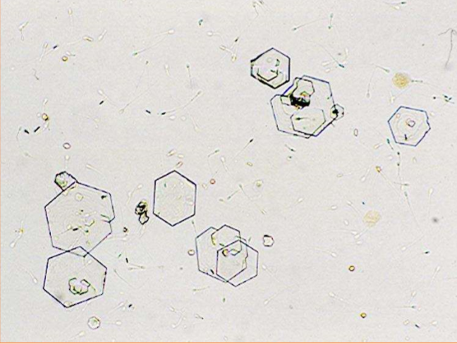 <p>Name the crystal</p>