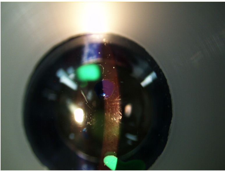 <p>which structure is in focus&nbsp;</p>