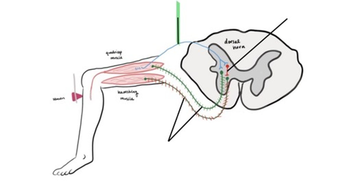 knowt flashcard image