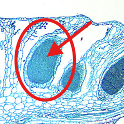 <p>What part of the Antheridial Head is the arrow pointing to?</p>