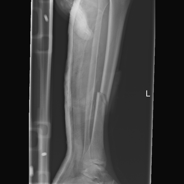 <p>Describe the abnormality demonstrated. </p>