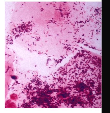 <ul><li><p>GPB</p></li><li><p>part of polymicrobial bacterial vaginitis</p></li><li><p>crescent-shaped or curved rods</p></li><li><p>motile with polar flagella</p></li><li><p>inconsistently GP</p></li></ul><p></p>