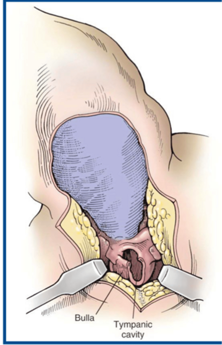 <p>what procedure is shown here</p>