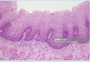 <p>What are non-keratinized cells?</p>