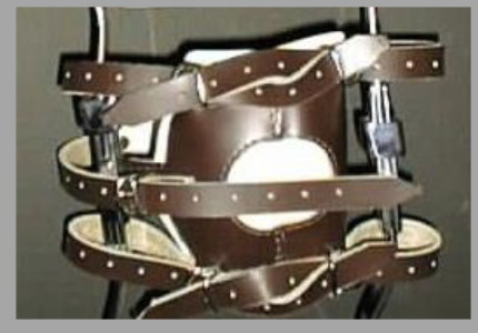 <p>5 buckle knee pad that wraps around the medial upright and <u>pulls</u> medially</p><p>OR </p><p>Lateral knee pad mounted on the lateral upright and <u>pushes</u> medially. </p>