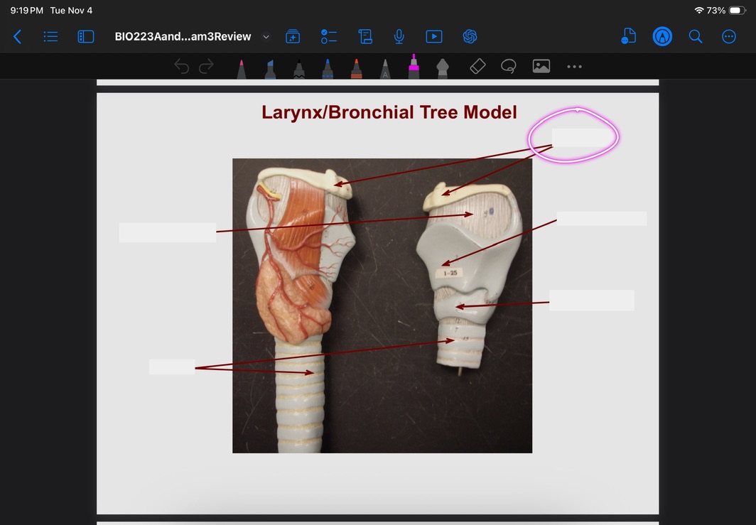 <p>What is this?</p>