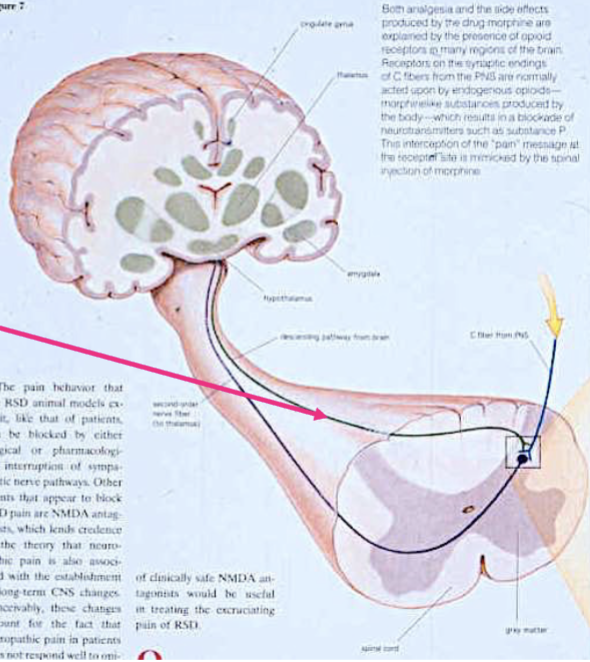 <p>enkephalins and endorphins (endogenous opiates) - released by descending inputs from brain (ex. periaqueductal gray in midbrain)</p><ul><li><p>block release of substance P</p></li></ul><p></p>