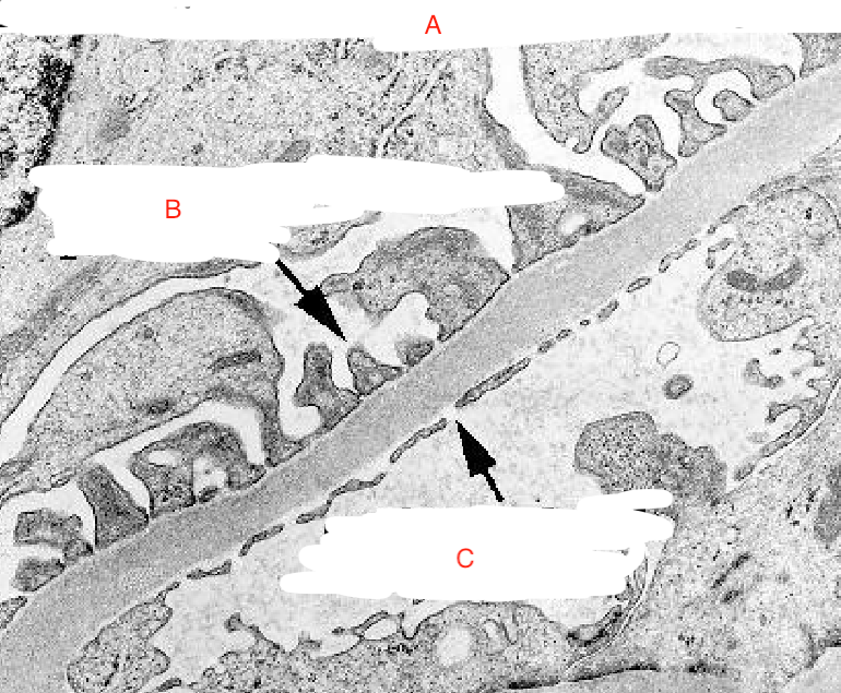<p>Endothelial Foot Process </p>