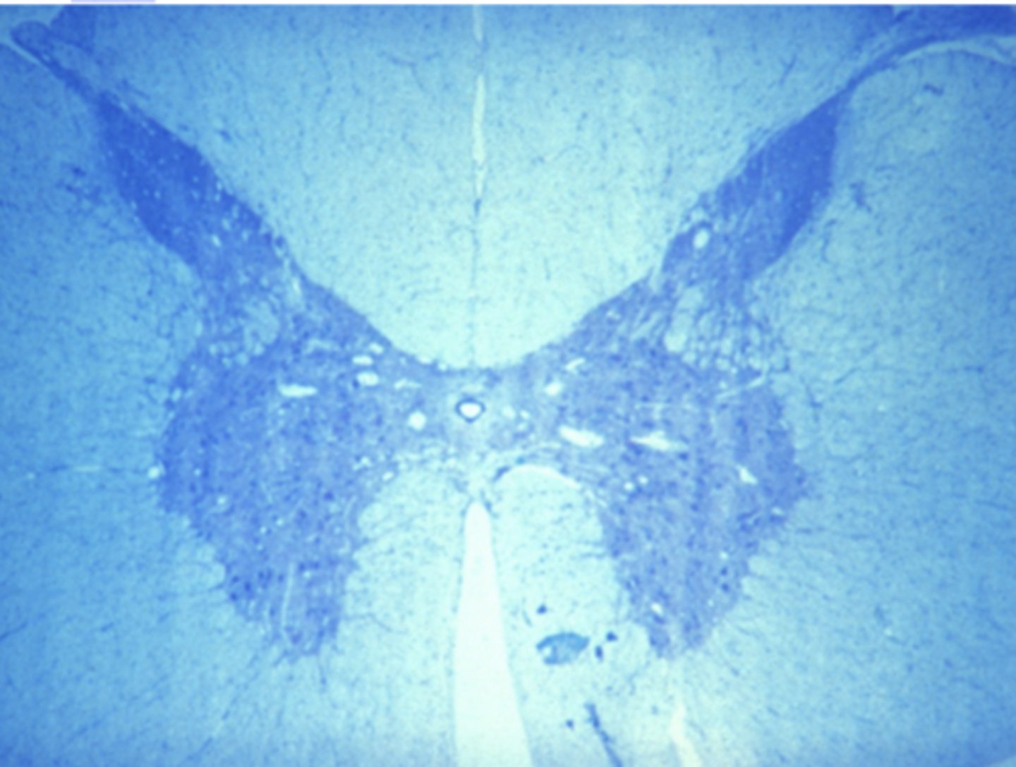 <p>Which of the four major tissue types is presented in the following image of the spinal cord:</p>