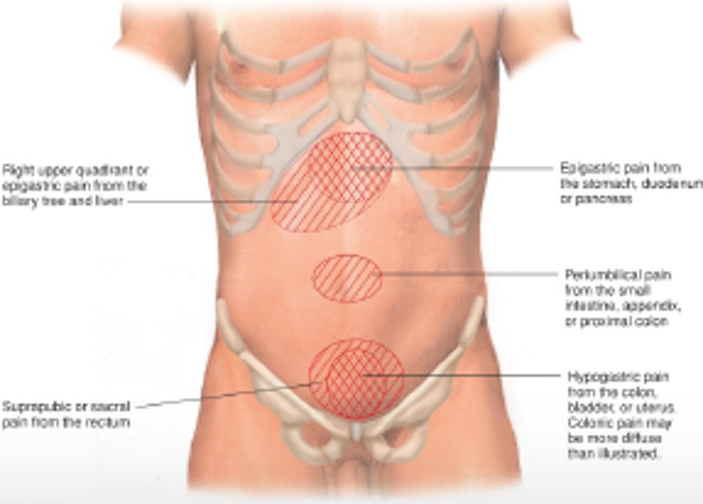 <p>a poorly localized, dull, or diffuse pain that arises from the abdominal organs, or viscera</p>