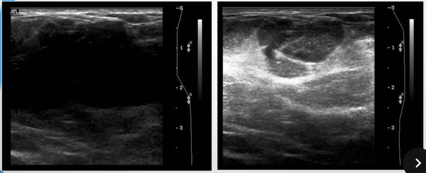 <p>describe the use of the TGCs on the images </p>