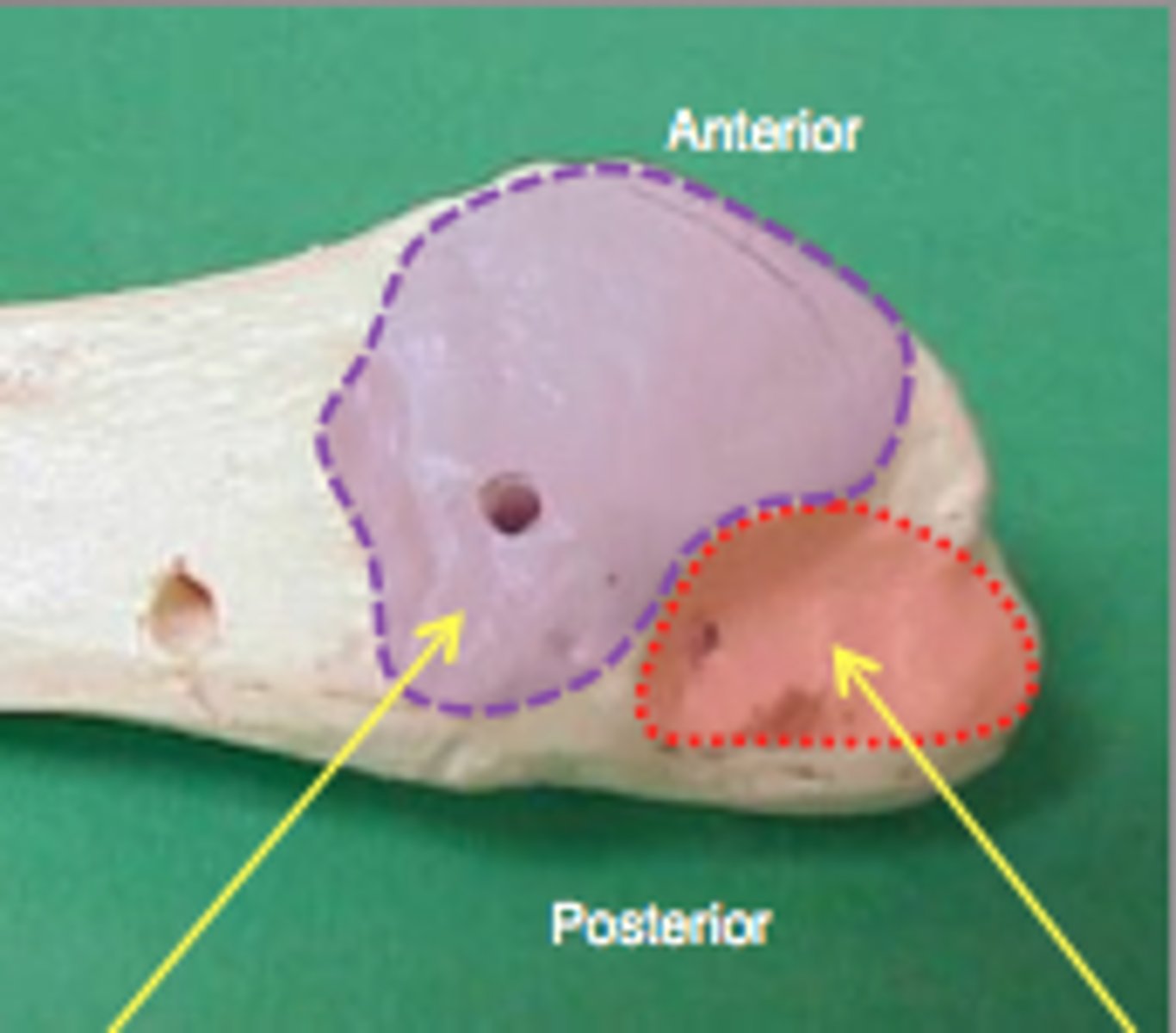 <p>located just posterior to the distal articular surface (red in image)</p>