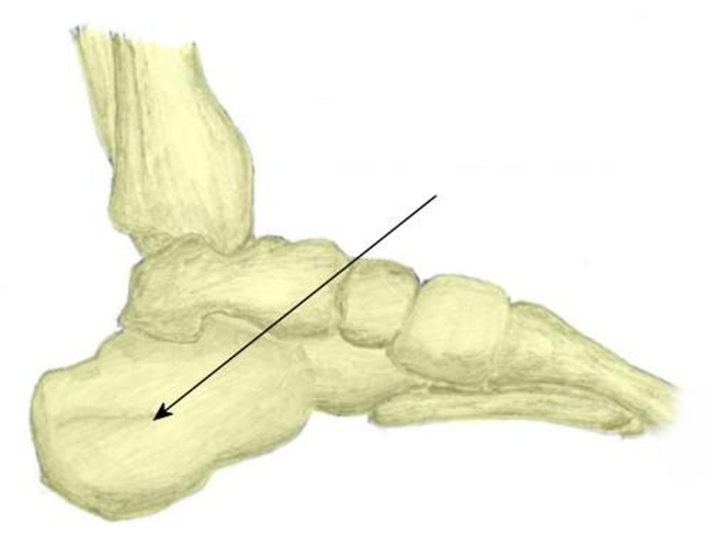 <p>ID bone</p>