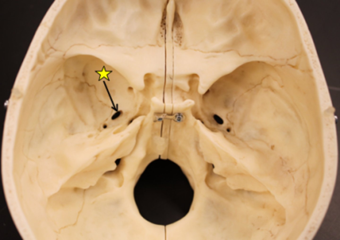 knowt flashcard image