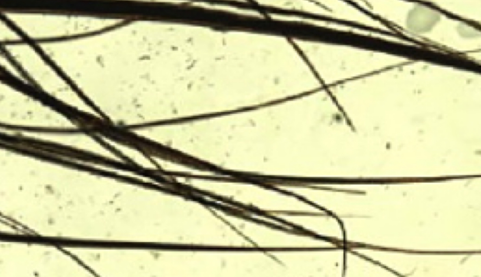 <p>Analyse what is in the photo</p>