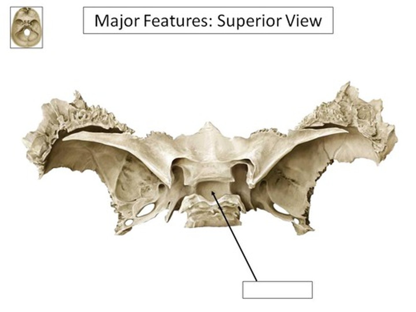<p>deep pit in "saddle"/sella turcicia</p>