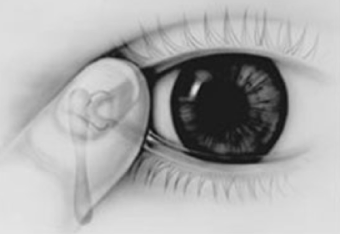 <p>close eyelids 2 mins & apply pressure to tear duct</p>