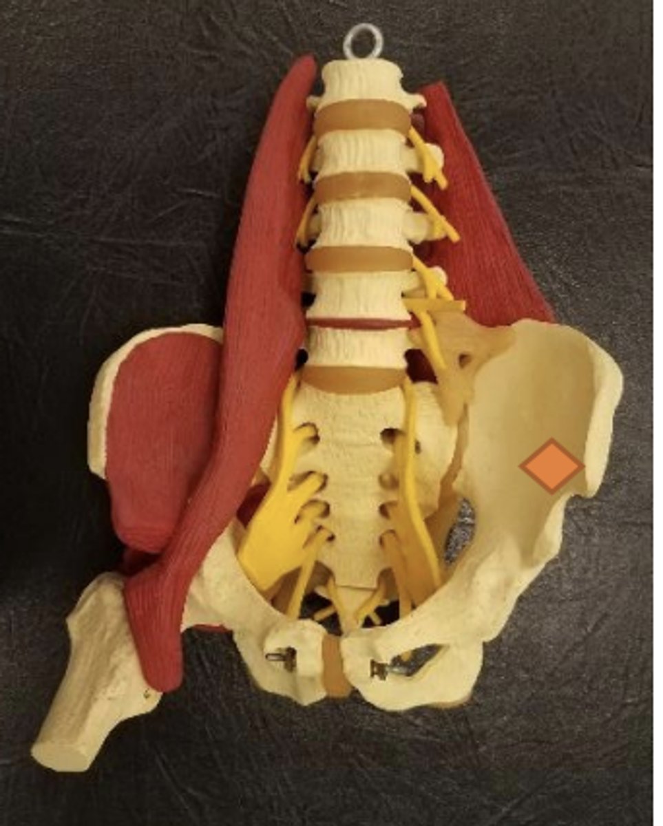 <p>medial to ASIS</p>