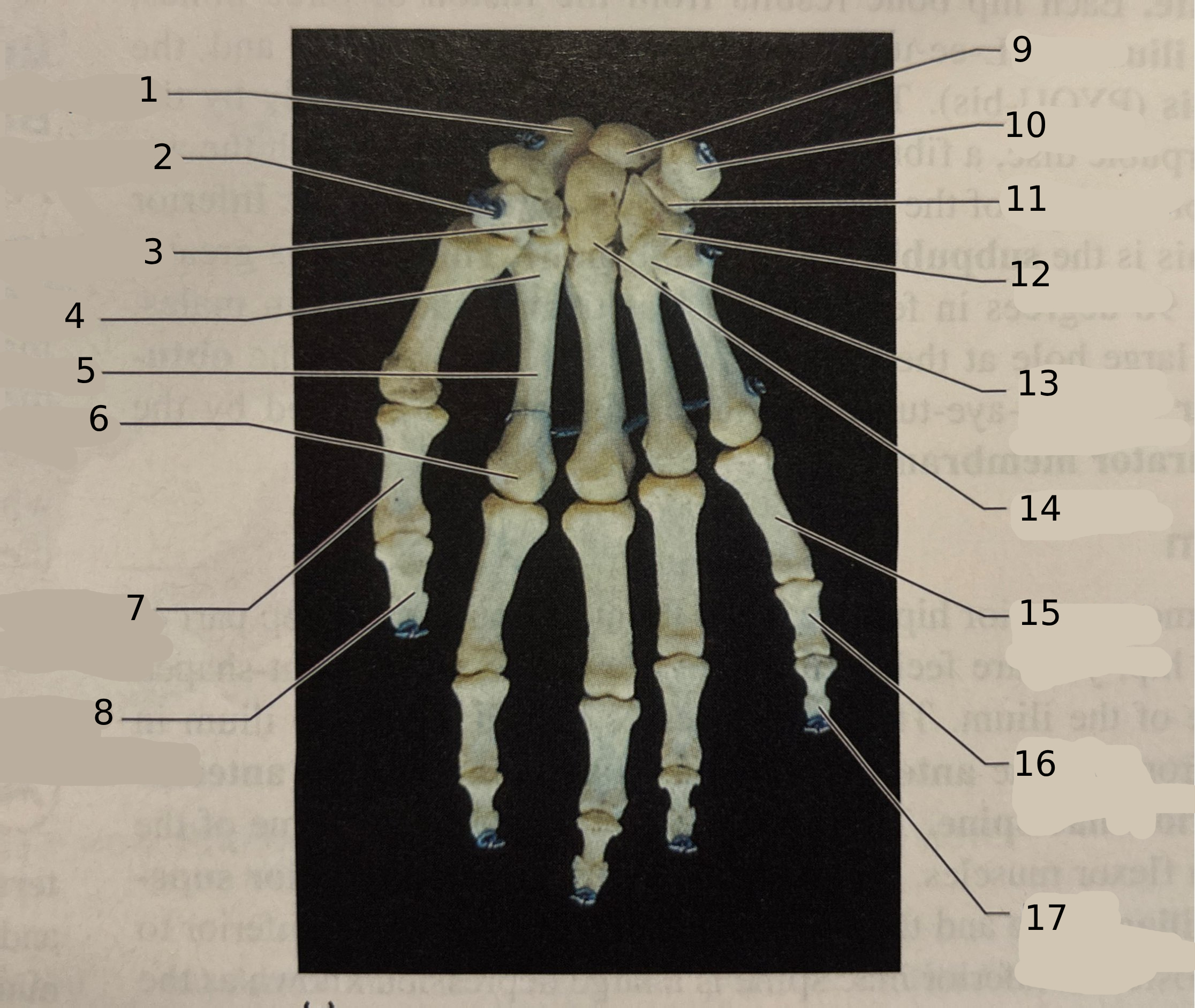<p>#3</p>