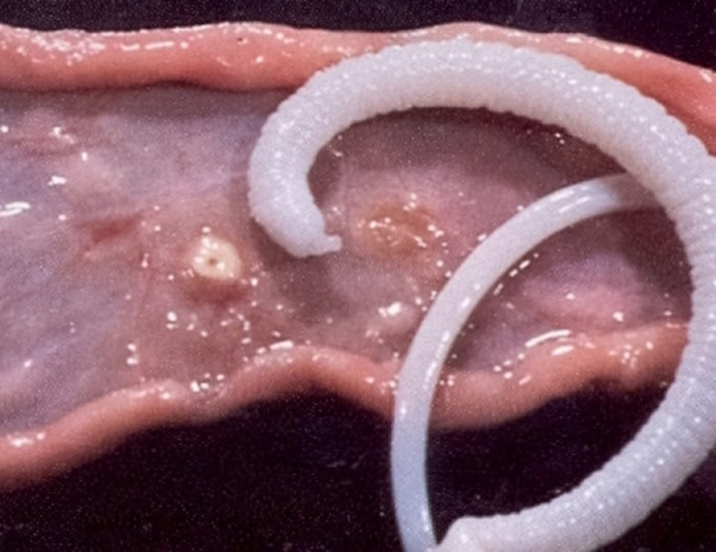 <p>This parasite was found attached to the small intestine of a pig at necropsy. What is it?</p>