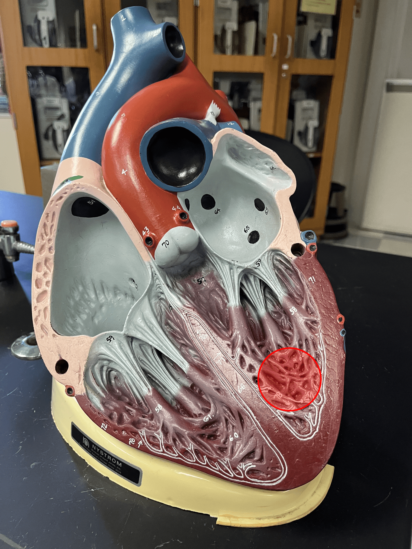 • Prominent ridges of cardiac muscle.

• Located in the ventricles of the heart.