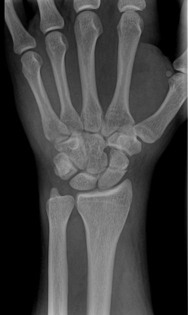 <p>Describe the abnormality demonstrated.</p>