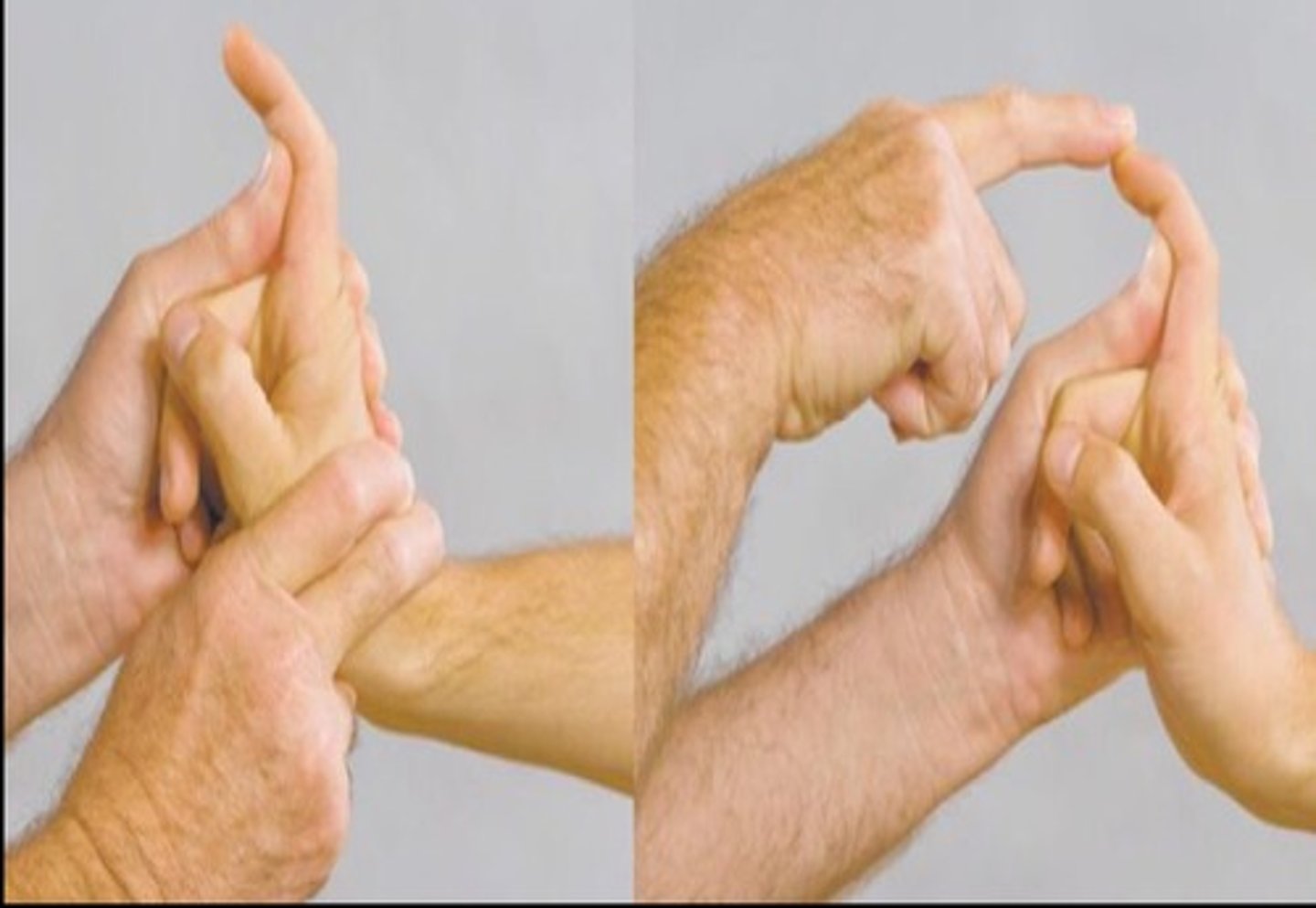 <p>Assesses if PIP flexion is restricted d/t intrinsic muscle tightness or PIP capsular restriction</p>