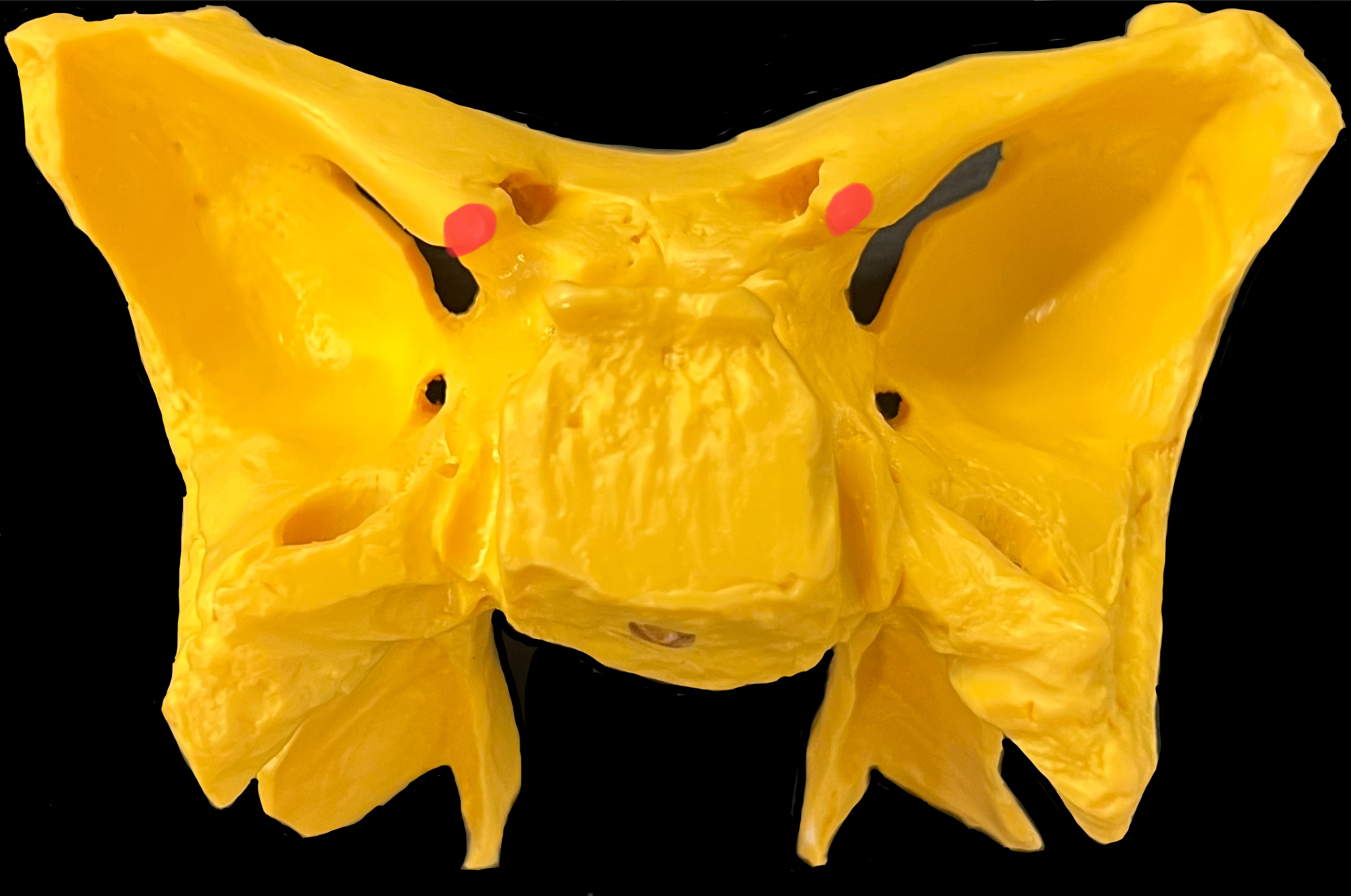 What is highlighted in red?