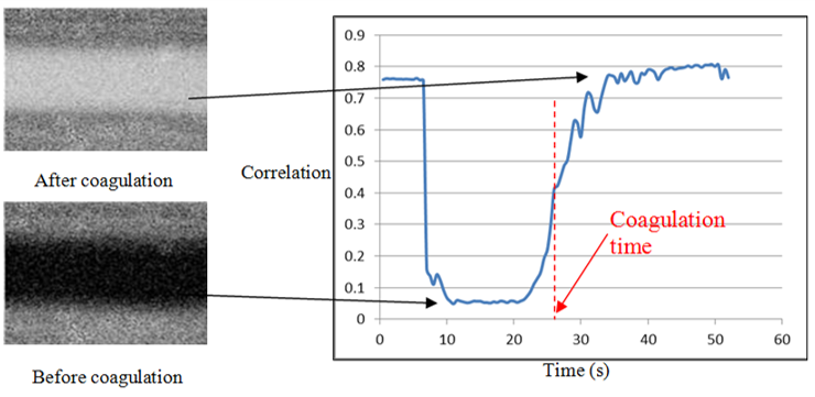 <ul><li><p>A picture generates a correlation factor that is 0 where the cells are moving (before coagulation) and 1 when the cells stop (after coagulation).</p></li><li><p>Pictures movements changes are illustrated by a colour change. </p></li><li><p>Sample goes from black to white when coagulation occurs.</p></li><li><p>Clotting time is detected by the sudden changes in the slope value of the correlation factor curve</p></li></ul><p></p>