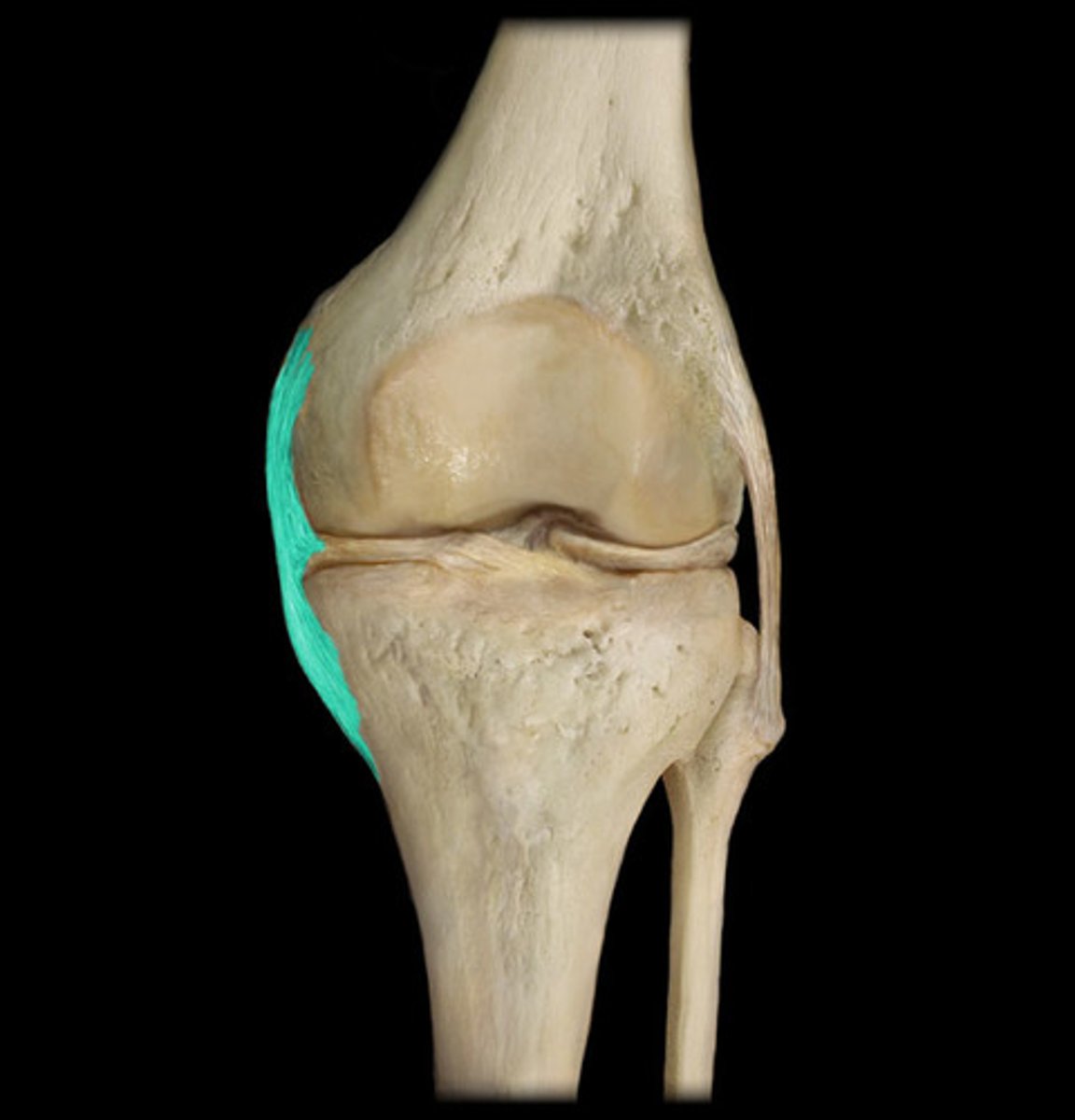 <p>medial side of the knee</p>