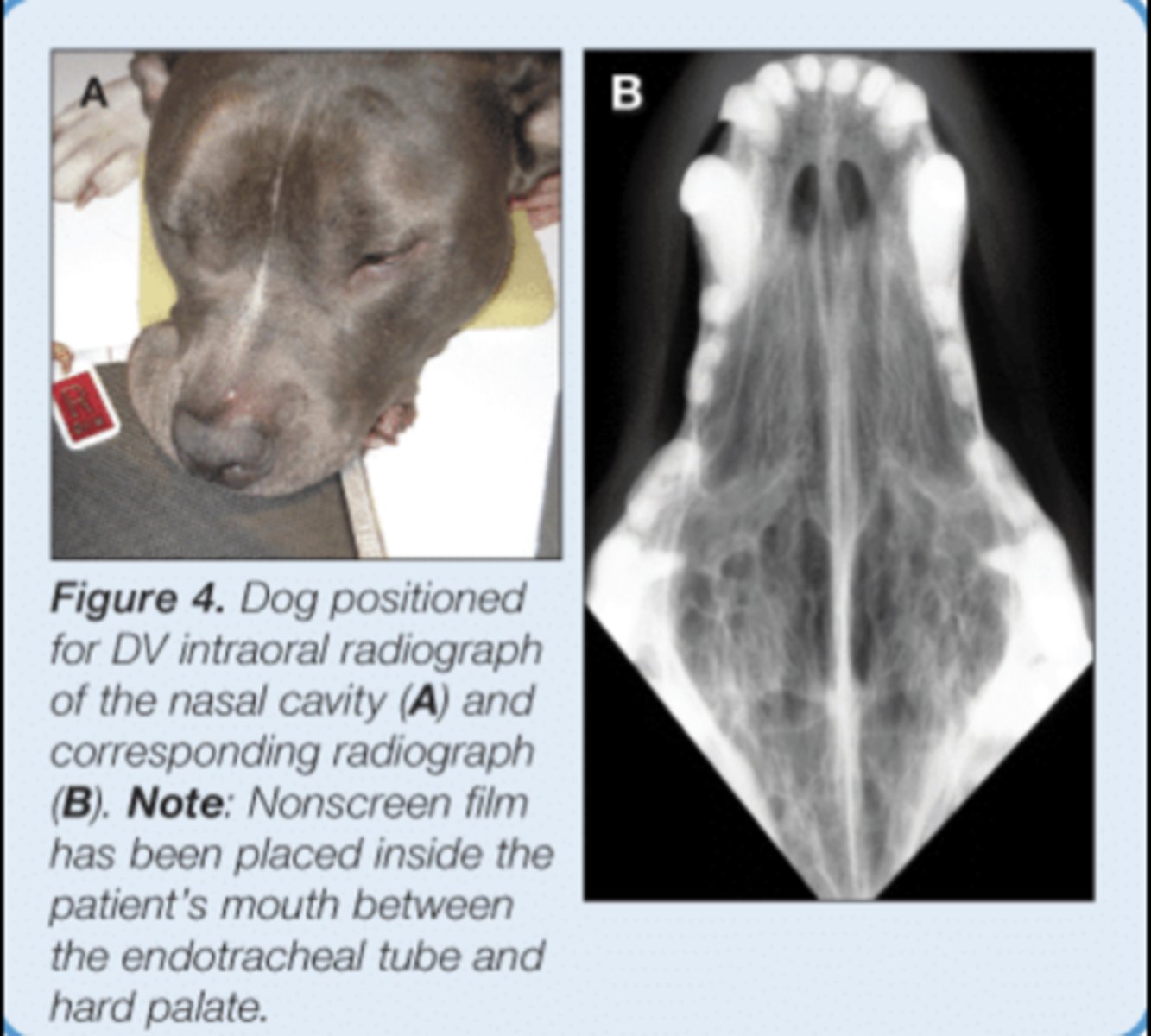 <p>• Patient internal recumbency</p><p>• Plate in mouth - May not be possible with digital plates</p><p>• Markers to indicate laterality</p>