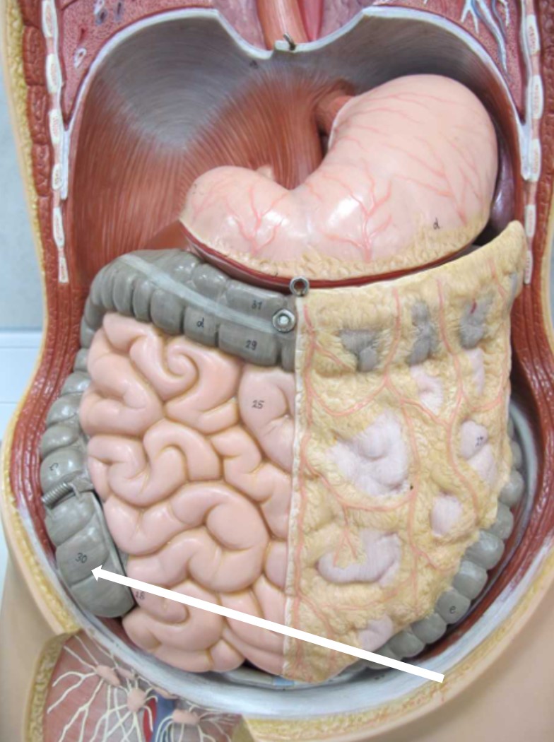 <p>deel aan begin colon ascendens</p>