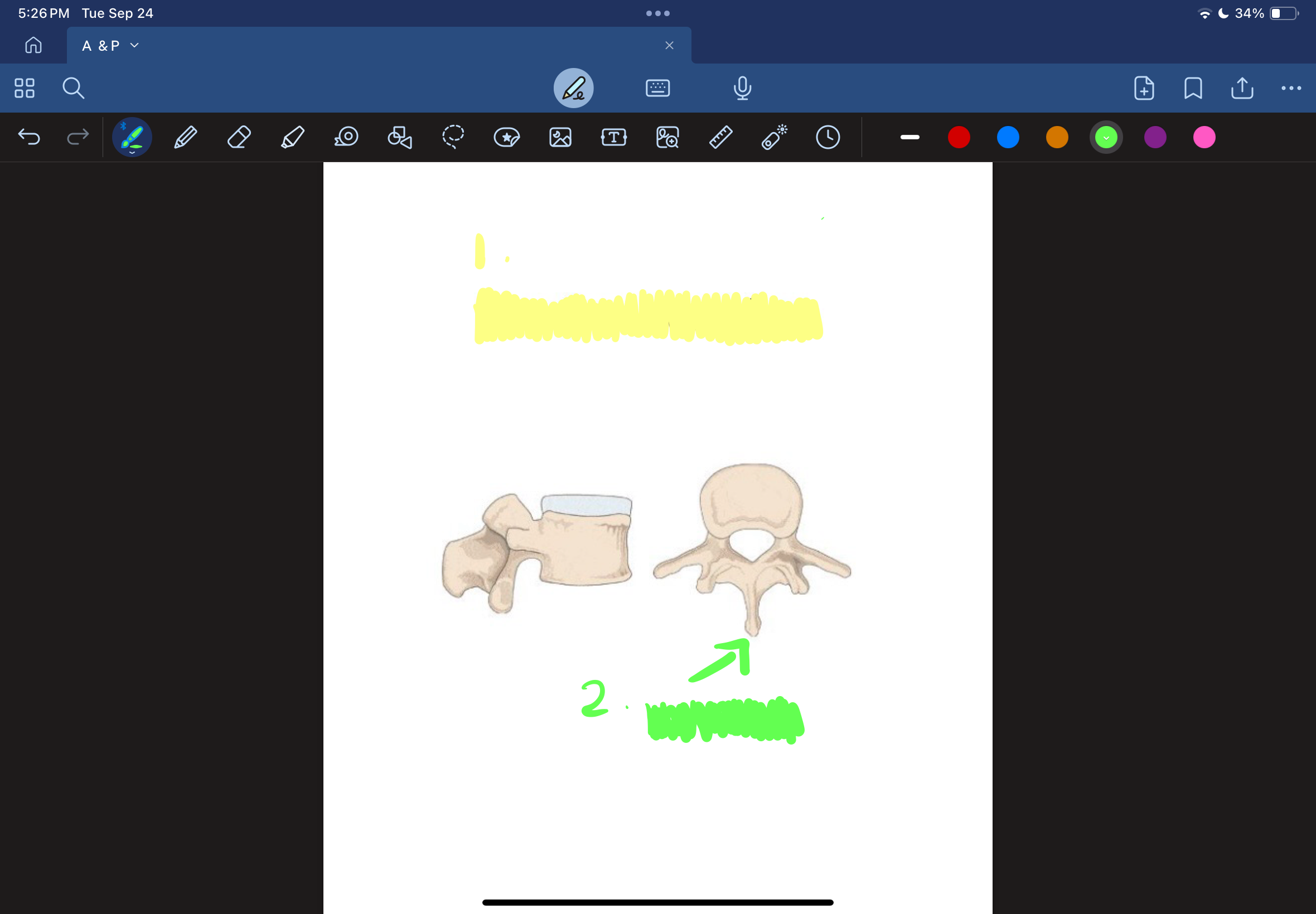 <ol><li><p>(Yellow)</p></li></ol>