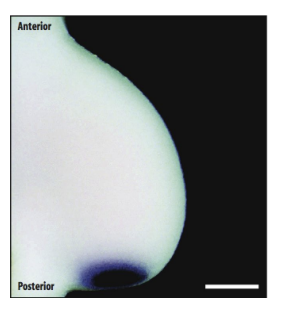 <ul><li><p>In situ hybridisation dark staning→ shows SONIC HEDGHOG <strong>transitps</strong></p></li><li><p>expressed by cells at the posterior margin of the limb bud</p></li><li><p>so Sonic hedgehog diffused anterioroly as a graded signal</p></li></ul><p>→ This is critical for patterning of the limb in this axis!</p><p></p>