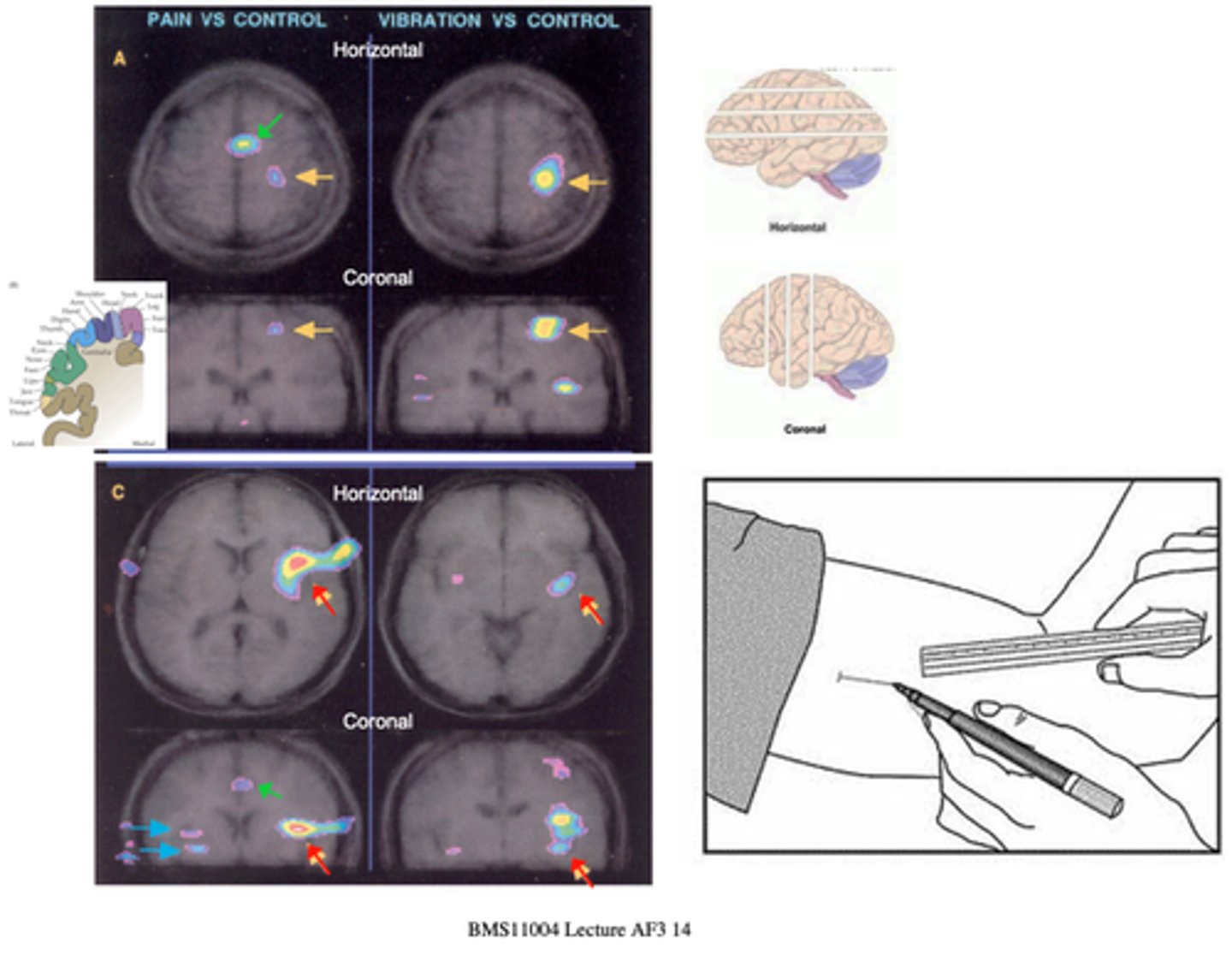<p>Pain activates a distinct response that includes other regions - notably is the activation of the insula (red) and the cingulate cortex (green), what are these regions connected to and involve?</p>