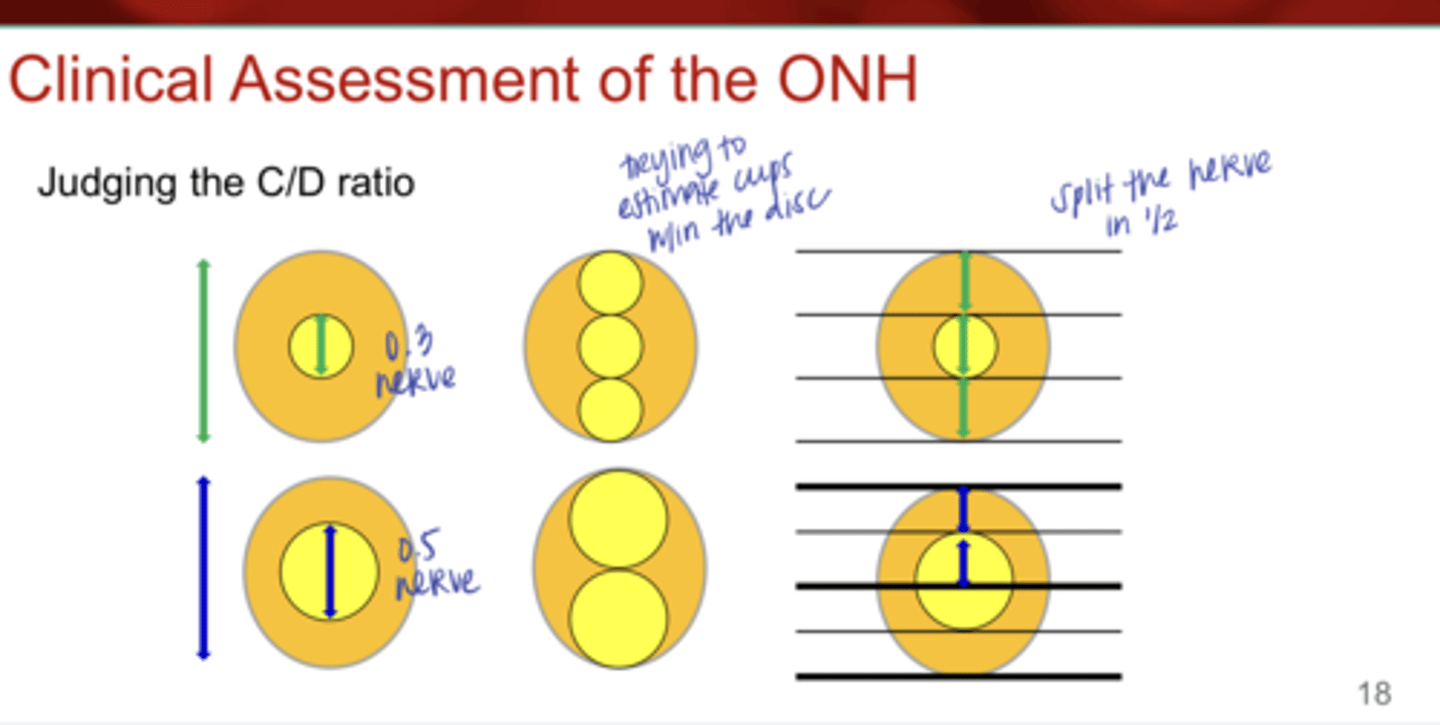 <p>Judging the C/D Ratio (Pic)</p>