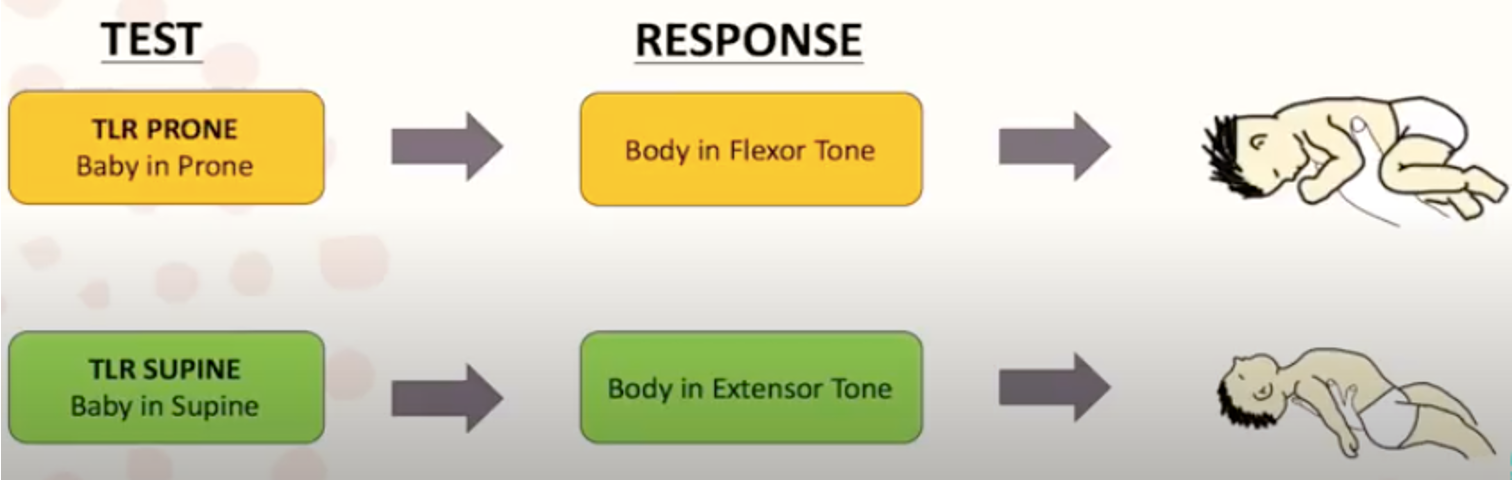 <p>Onset: 37 Weeks Gestation</p><p>Integration: 6 Months</p><p>Function: </p><p>Development of Balance, Body Position &amp; Stability</p><p>Balances Flexion and Extension Tone</p><p>Head Neck Alignment and control</p><p>Body/Head Trunk Dissociation </p><p>there are 2 aspects of TLR: TLR PRONE and TLR Supine.</p><p>Retained: TLR: prone flexion and supine extension</p>
