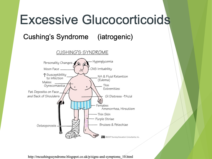 <p>Cushing’s syndrome </p><p></p><ul><li><p>moon face</p></li><li><p>high blood pressure</p></li><li><p>CVD</p></li><li><p>Diabetes</p><ul><li><p>Skin thinning</p></li></ul></li></ul><p></p><p></p>