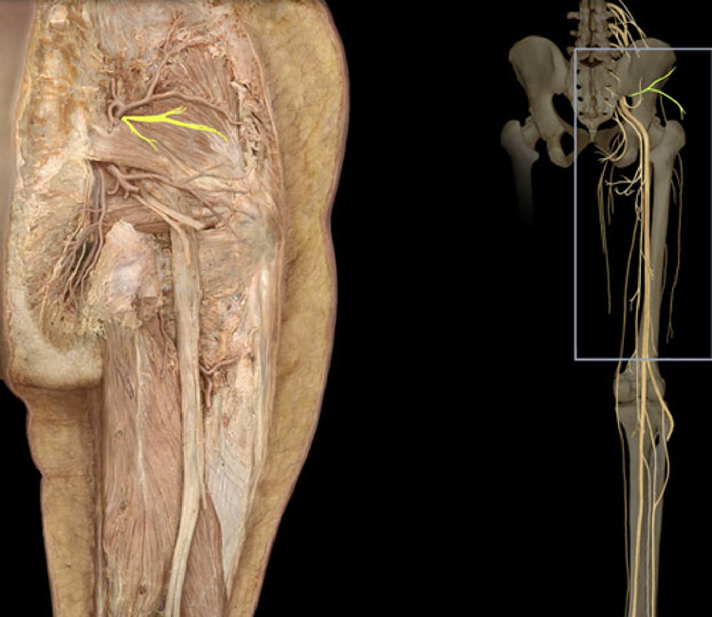<p>nerve to quadratus femoris (L4-S1)</p>
